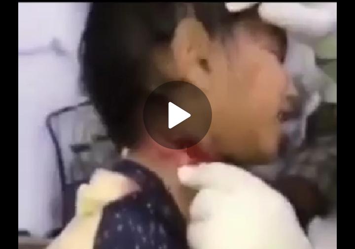 Sayatan Di Leher Belita Dikabarkan Korban Penculikan Anak