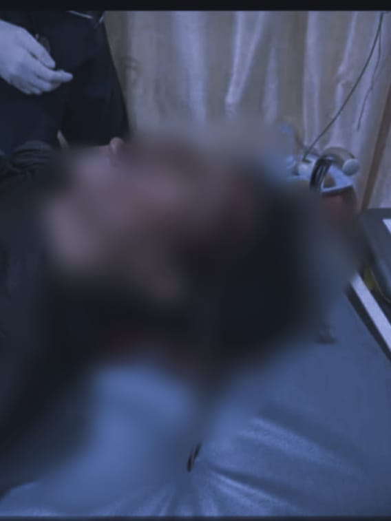 Hoax, Foto Kepala Tersayat Celurit Diduga Korban Dari Balas Demdam Pembacokan