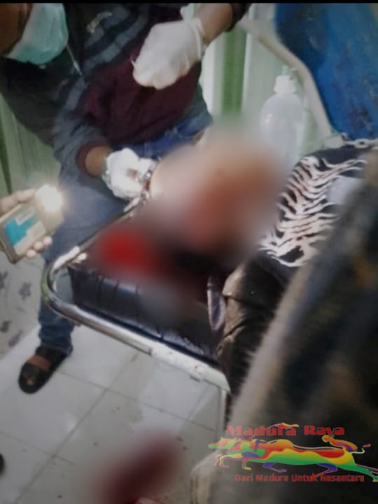 Pemuda di Pamekasan Dibacok Sekelompok Orang Tak dikenal